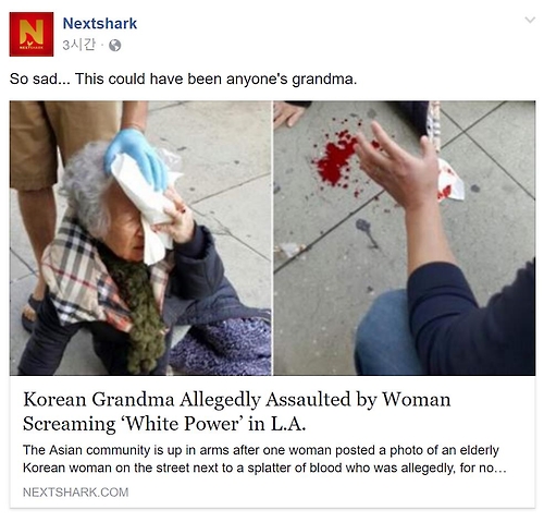 한국할머니, LA서 느닷없는 피습…백인여성 혐오 범죄인듯