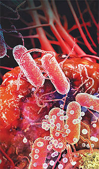 세균 잡는 항생제, 바이러스엔 무용지물