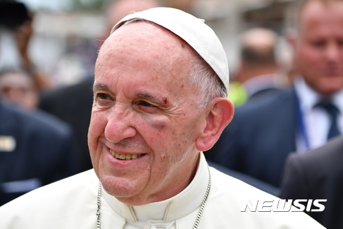 교황, 콜롬비아서 차량 급제동에 눈두덩 멍…“괜찮습니다”