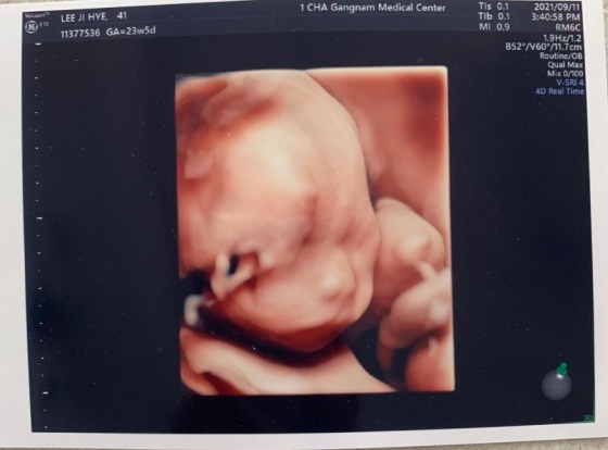 ‘임신 7개월’ 이지혜, 둘째 3D 초음파 사진 공개 “똑닮았네”