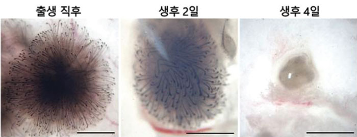 ‘모낭 세포’ 소멸 원인 규명… 탈모 예방 길 열었다