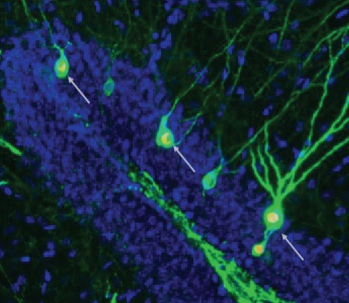 “신경세포 생성 촉진으로 알츠하이머 쥐 기억력 회복”