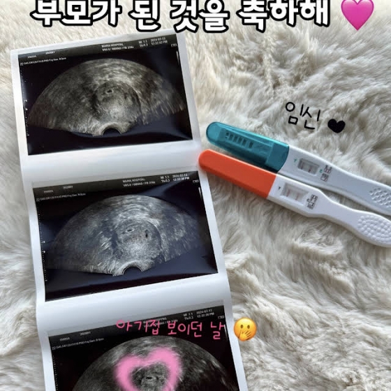 박수홍♥김다예, 결혼 3년만 임신