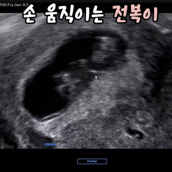 박수홍♥김다예, 결혼 3년만 임신